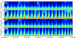 Kaggle Featured  Competition - HMS - Harmful Brain Activity Classification